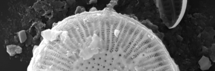 A single-celled creature seen through a microscope.